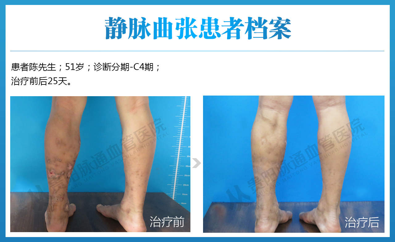 胡斌-男-51-C4.jpg
